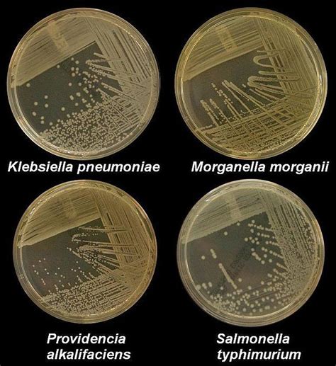 Growing Bacteria In The Lab Gcse