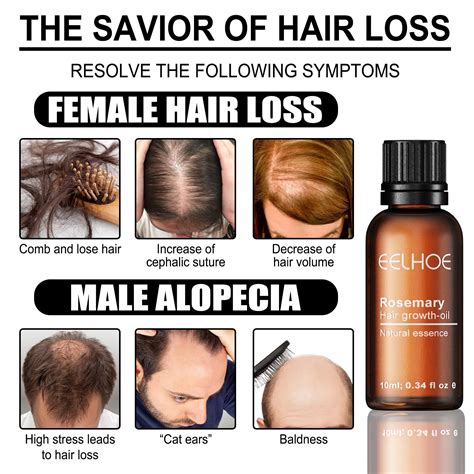 Buy Hair Growth Drops Rosemary Oil Peptides Minoxidil Hair Loss