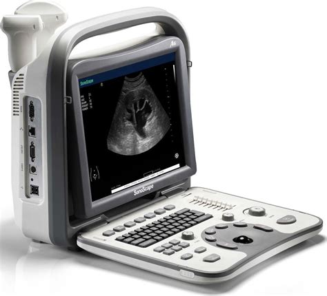 Ec Grafo Veterinario Port Til Sonoscape A V Diagnostic Imaging