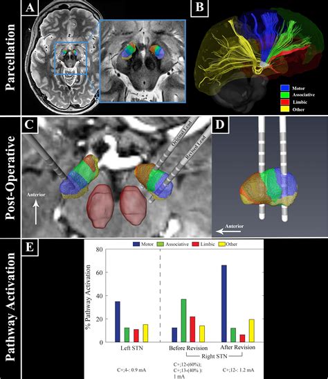 Frontiers 7t Mri And Computational Modeling Supports A Critical Role