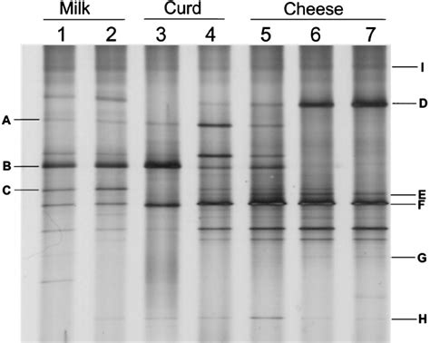 Dgge Pro Fi Les Of Amplicons Generated By Pcr With The Lactobacillus Download Scientific