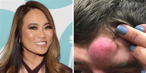 Dr Pimple Popper Reveals The Deeper Meaning Behind Her Videos