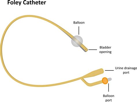 Induction Methods - Balloon Catheter | Back to Basics Birthing