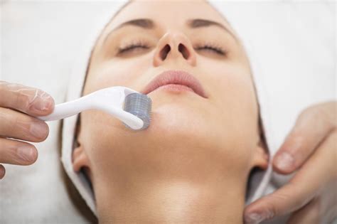 Microneedling Eine ideale Methode zur Verjüngung der Haut und zur