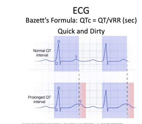 Pathophysiology Of Dysrhythmias Flashcards Quizlet