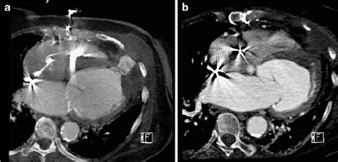 A 67 Year Old Female Patient Presented To The Emergency Department With