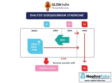 Major Acute Hemodialysis Complications - Hoping to Prevent - Dr. Gawad