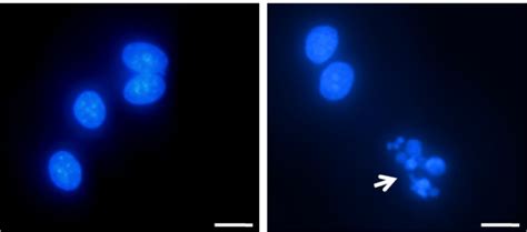 Cells Subjected To Dapi 4′6 Diamidino 2 Phenylindole Staining Download Scientific Diagram