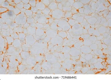 Humanbody Fat Cells Under Microscope View Stock Photo 719686441 ...