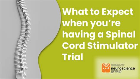 How To Prepare For A Spinal Cord Stimulator Scs Trial Youtube