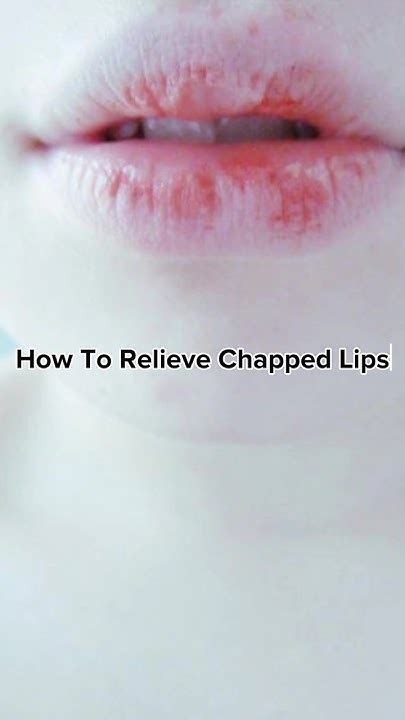 How To Relieve Chapped Lips 👄 Viral Shorts Aesthetic Tips Fyp