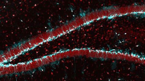 Reactivating Aging Stem Cells in the Brain | Technology Networks