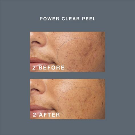 Pro Power Peel Elixir Beauty