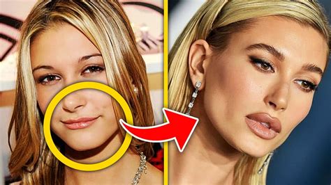 Top Celebrities That Ruined Their Face With Botched Lip Fillers