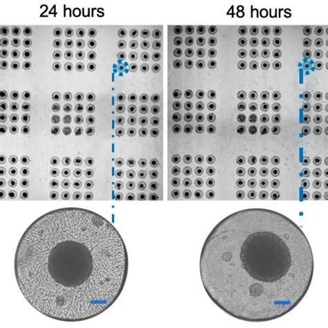 Formation Of Uniform And Compact Spheroids Of Colon Cancer Cell Line Download Scientific