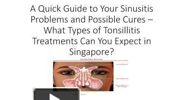 Ppt A Quick Guide To Your Sinusitis And Tonsillitis Treatments