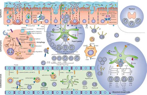 Crohn S Disease The Lancet