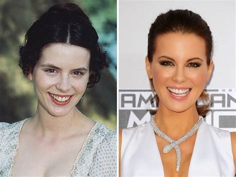 Kate Beckinsale Before and After Plastic Surgery: face, nose, breast