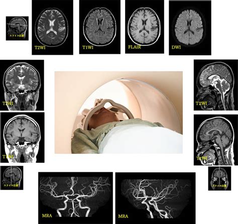 Mri検査のご紹介 独立行政法人 国立病院機構 さいがた医療センター
