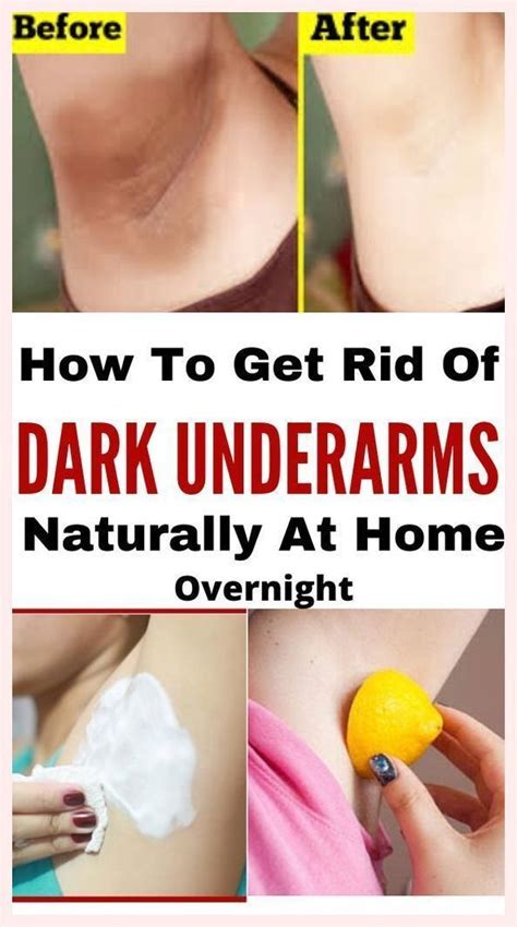 How To Lighten Dark Underarms Fast With 2 Natural Ingredients Artofit