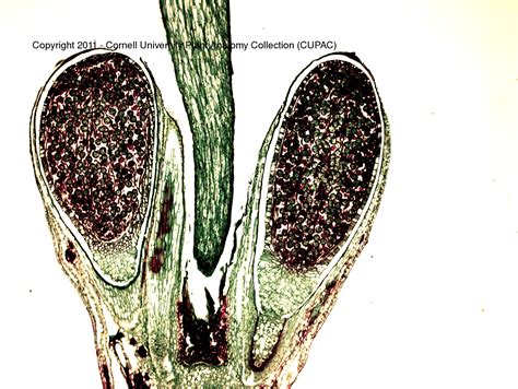 CUPAC ANATOMY SLIDE IMAGES