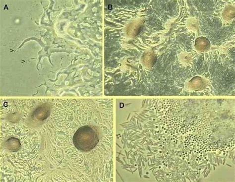 Myxobacteria - Alchetron, The Free Social Encyclopedia 
