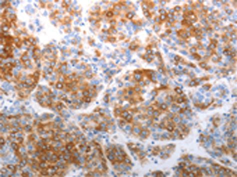 Cdh Anti Chd Rabbit Polyclonal Antibody