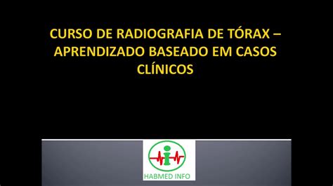 Curso De Radiografia De Tórax Aprendizado Baseado Em Casos Clínicos Youtube