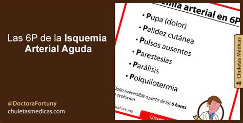 Las 6P de la Isquemia Arterial Aguda - Chuletas Médicas