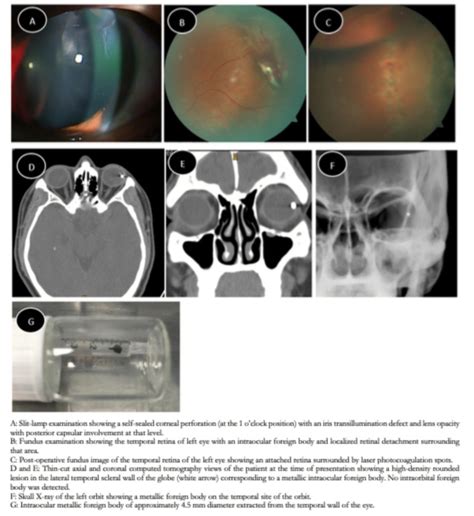 The Role Of Various Imaging Techniques In Identifying And Locating