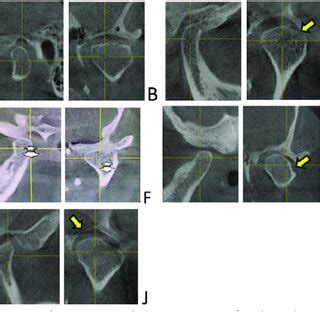 Cone Beam Computed Tomography Cbct Sagittal And Cross Sectional Views