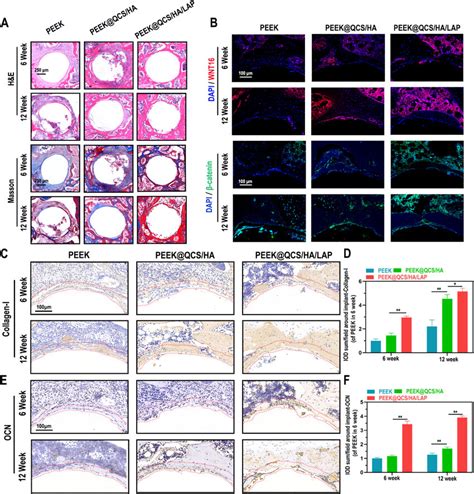 Effects Of Qcs Ha Lap Coating On Wnt Catenin Axis In Vivo A H E