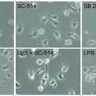 Morphological Changes Of Microglia Activated By LPS Representative