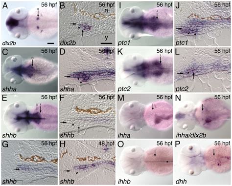 Hedgehog Signaling Is Required At Multiple Stages Of Zebrafish Tooth