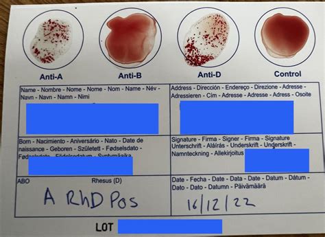 Close Home Abo Blood Type Testing Stock Photo 1604951320, 55% OFF