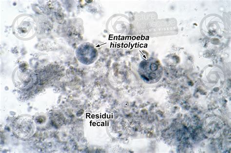 Entamoeba Histolytica Amebiasi 250x Protozoa Protozoi Endoparassiti Parassitologia Foto