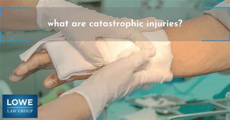 What Are Catastrophic Injuries