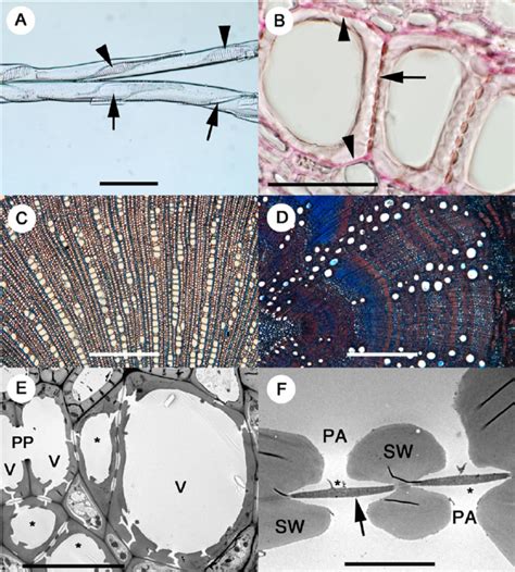 Light (A–D) and transmission electron (E–F) microscope images of...