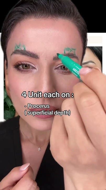 Botox For Hooded Eyes Youtube