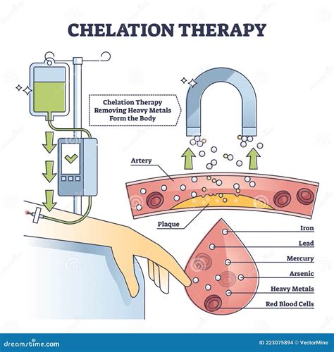 Chelatietherapie Voor De Behandeling Van Toxische Zware Metalen Schema