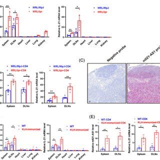 The Expression Of Il As In Systemic Lupus Erythematosus Sle