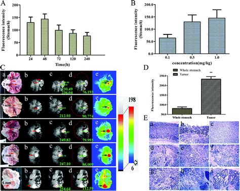 Photodynamic Diagnosis Of Gastric Cancer Using Hpph Cd Rsc Advances