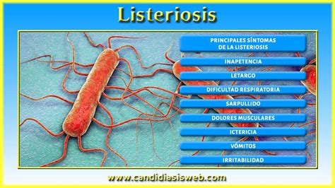 Infecciones Bacterianas Listeriosis