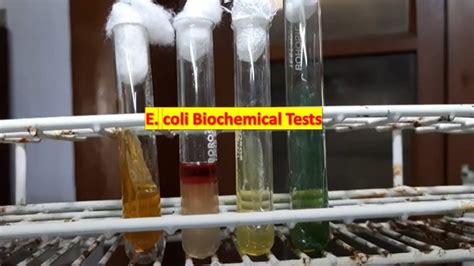 E Coli Biochemical Tests Demonstration Youtube