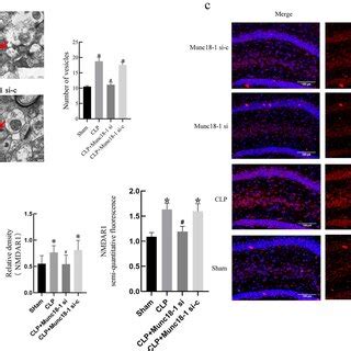 The expression of Munc18-1, Synataxin1A and Synaptophysin at different ... 