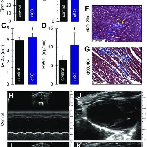 Giant AnkG CKO Mice Demonstrate A Dilated Cardiomyopathy Phenotype