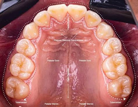 Paladar anatomia Anatomía dental Dental Odontología