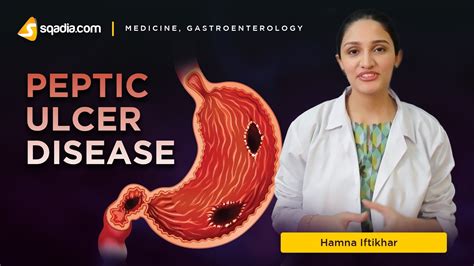 Peptic Ulcer Disease Introduction