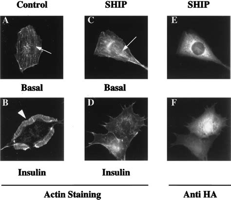 Effects Of SHIP Overexpression On Insulin Induced Actin Rearrangement