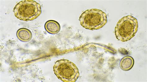 Tapeworm Segments In Human Stool